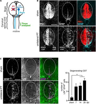 LZK-dependent stimulation of astrocyte reactivity promotes corticospinal axon sprouting